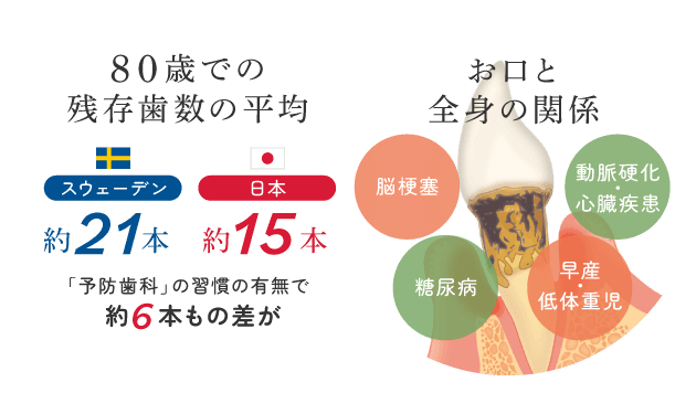 80歳での残存歯数の平均/お口と全身の関係