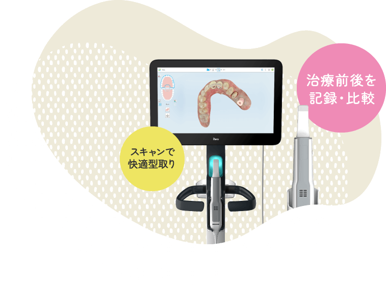 スキャンで快適型取り、治療前後を記録・比較